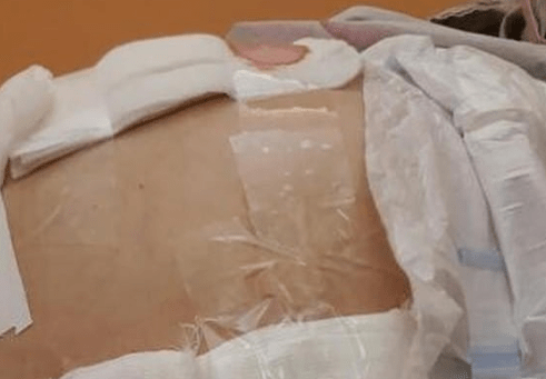 Naturellement, Anna a partagé ses pensées avec un infirmier, mais il l'a repoussée, affirmant que le service de chirurgie avait simplement manqué de pansements stériles.